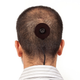 Illustration for article titled That NYU Professor With a Camera Surgically Attached to His Head? Yeah, His Bodys Rejecting It